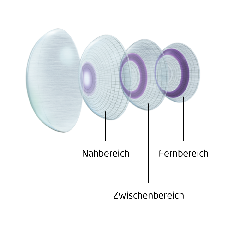 Aufbau von Gleitsichtkontaktlinsen