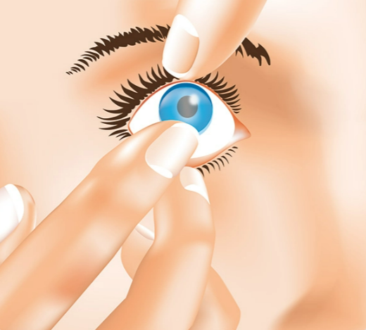 Kontaktlinse absetzen